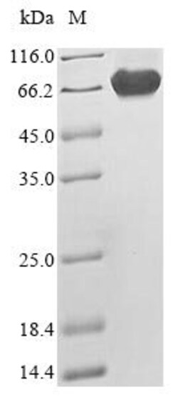 Biomatik Corporation Recombinant Human Merlin (NF2), Quantity: Each of