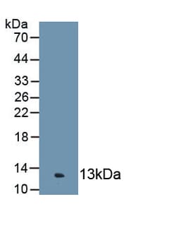 Biomatik Corporation Complement Component 4C (C4C) Polyclonal Antibody,