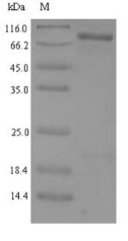 Biomatik Corporation Recombinant Human NAD-dependent protein deacetylase