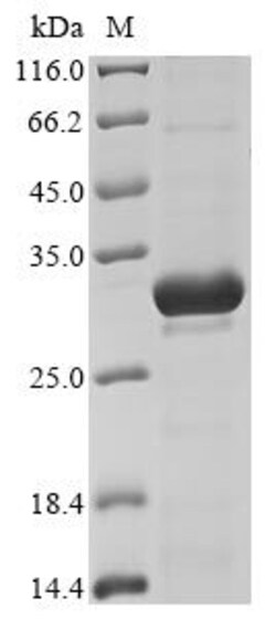 Biomatik Corporation Recombinant Escherichia coli O157:H7 Metalloprotease
