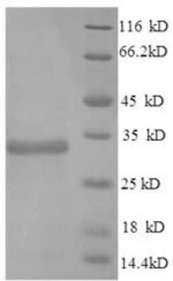 Biomatik Corporation Recombinant Mouse Apolipoprotein E (Apoe), Quantity: