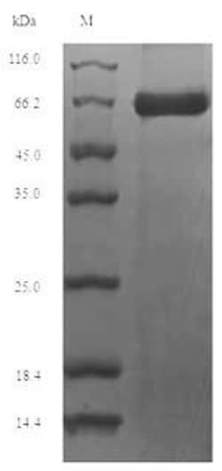Biomatik Corporation Recombinant Mouse Perforin-1 (Prf1), Quantity: Each