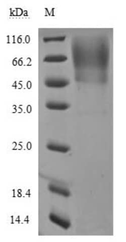 Biomatik Corporation Recombinant Severe acute respiratory syndrome coronavirus