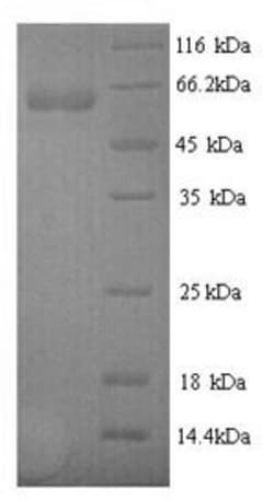 Biomatik Corporation Recombinant Human N-acetylmuramoyl-L-alanine amidase
