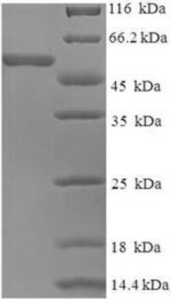 Biomatik Corporation Recombinant Human coronavirus OC43 Spike glycoprotein