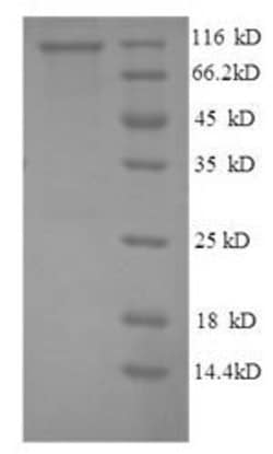 Biomatik Corporation Recombinant Human NADPH--cytochrome P450 reductase
