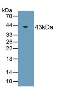 Biomatik Corporation Actin (Actin) Polyclonal Antibody, Quantity: Each