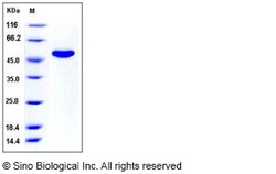Sino Biological Recombinant Mouse CNDP2 Protein (His Tag), Quantity: Each