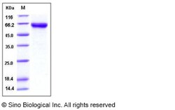 Sino Biological Recombinant Mouse DKK-3 Protein (His Tag), Quantity: Each