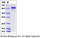 Sino Biological Recombinant Mouse Chk1 Protein (His & GST Tag), Quantity: