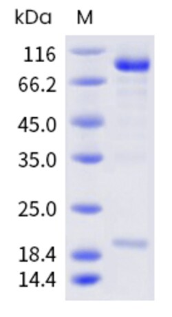 Sino Biological Recombinant Mouse PCSK9 Protein (mFc Tag), Quantity: Each