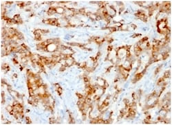 Biotium Beta-2 Microglobulin (Renal Failure & Tumor Marker)(rB2M/961),