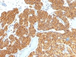 Biotium PTH / Parathyroid Hormone (N-Terminal)(PTH/911), 0.2mg/mL, Quantity: