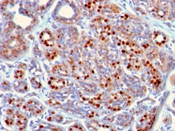 Biotium GATA-3 (Breast and Urothelial Marker)(GATA3/2442), CF594 conjugate,