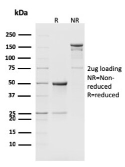 Biotium CD8b, Mouse(H35-17.2), CF594 conjugate, 0.1mg/mL, Quantity: Each