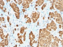 Biotium S100B (Astrocyte and Melanoma Marker) (S100B/1706R), CF594 conjugate,