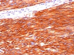 Biotium&nbsp;CD117C117370 CF594 conjugate 0.1mgmL