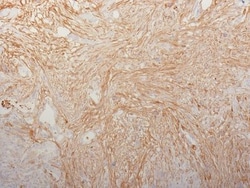 Biotium&nbsp;Fibronectin(HFN7.1), CF594 conjugate, 0.1mg/mL