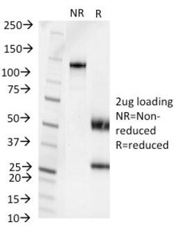 Biotium&nbsp;Pseudomonas aeruginosa serotype 6C(1200/472),  CF594 conjugate, 0.1mg/mL
