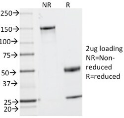 Biotium CD2 / Lymphocyte Function Antigen 2 (LFA-2)(UMCD2), CF594 conjugate,