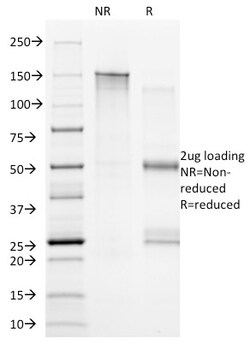 Biotium&nbsp;CD20(B9E9), CF594 conjugate, 0.1mg/mL