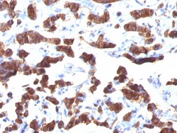 Biotium Thyroglobulin (Thyroidal Cell Marker)(TGB24), CF594 conjugate,