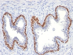 Biotium p63 (Squamous, Basal & Myoepithelial Cell Marker)(TP63/11), CF594