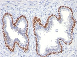 Biotium p63 (Squamous, Basal & Myoepithelial Cell Marker)(TP63/11), CF594