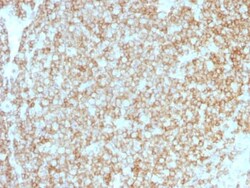 Biotium CD45 / LCA (Leucocyte Marker) (PTPRC/1783R + PTPRC/1975R), CF488A