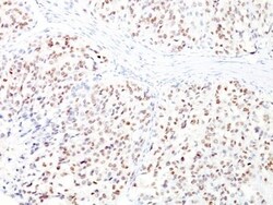 Biotium&nbsp;MiTF (Microphthalmia Transcription Factor)(D5 + MITF/915), CF488A conjugate, 0.1mg/mL