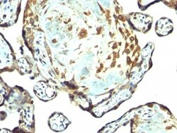 Biotium&nbsp;TIMP3(Rabbit PAb), CF488A conjugate, 0.1mg/mL