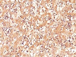 Biotium AFP Alpha FetoproteinC3 CF488A conjugate 0.1mgmL, Quantity: Each