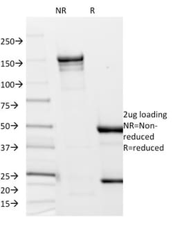 Biotium Borrelia burgdorferi (p41 Flagellin)(6802), CF488A conjugate, 0.1mg/mL,