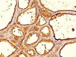 Biotium&nbsp;Thyroglobulin(6E1.), CF488A conjugate, 0.1mg/mL