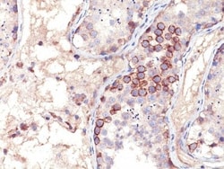 Biotium&nbsp;MAGE A1(MA454), CF488A conjugate, 0.1mg/mL