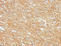 Biotium CD56 / NCAM(123A8, same as 56C04), CF568 conjugate, 0.1mg/mL, Quantity: