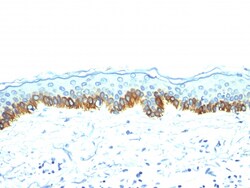 Biotium Cytokeratin, Acidic (Type I or LMW) (Epithelial Marker)(AE-1),