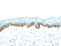 Biotium Cytokeratin, Acidic (Type I or LMW) (Epithelial Marker)(AE-1),