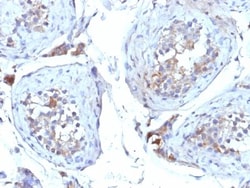 Biotium SHBG (Sex Hormone Binding Globulin)(SHBG/245), CF568 conjugate,