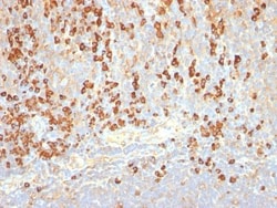 Biotium Plasma Cell Marker(LIV3G11, same as 7B18), CF568 conjugate, 0.1mg/mL,