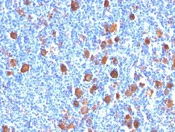 Biotium&nbsp;Fascin-1(FSCN1/416), CF647 conjugate, 0.1mg/mL