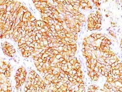 Biotium&nbsp;Renal Cell Carcinoma (Carbonic Anhydrase IX)(66.4.C2), CF647 conjugate, 0.1mg/mL