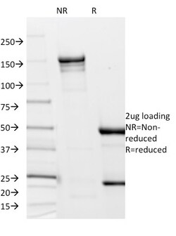 Biotium Borrelia burgdorferi (p41 Flagellin)(6802), CF647 conjugate, 0.1mg/mL,