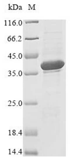 Biomatik Corporation Recombinant Human Ribonuclease H1 (RNASEH1), Quantity: