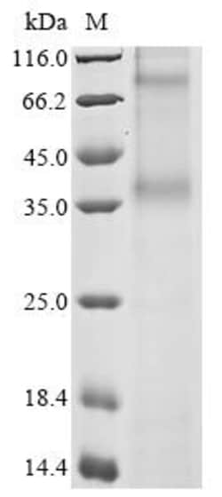 Biomatik Corporation Recombinant Human C-C chemokine receptor type 8 (CCR8),