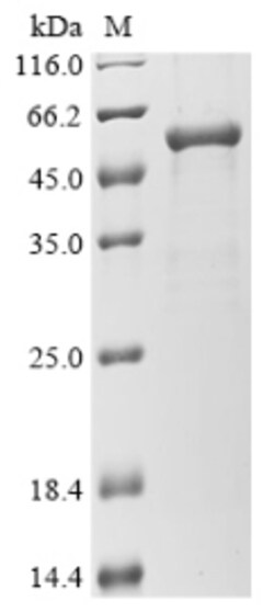 Biomatik Corporation Recombinant Human Gasdermin-D (GSDMD), Quantity: Each