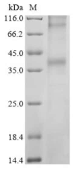 Biomatik Corporation Recombinant Human Long-wave-sensitive opsin 1 (OPN1LW),