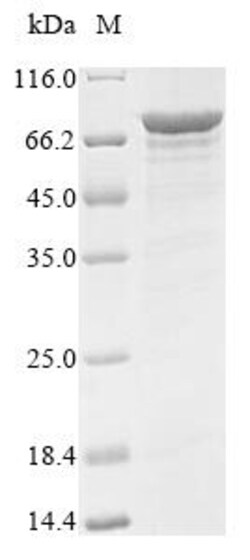 Biomatik Corporation Recombinant Human Probable ATP-dependent RNA helicase