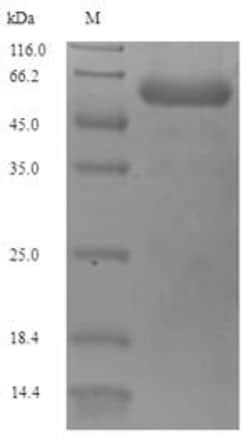 Biomatik Corporation Recombinant Pseudomonas aeruginosa Porin P (oprP),