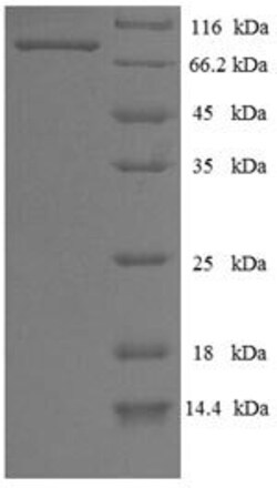 Biomatik Corporation Recombinant Influenza B virus Nucleoprotein (NP),